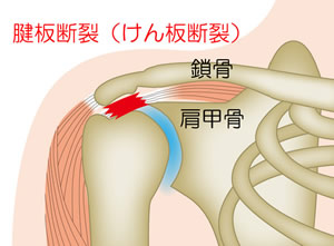 腱板とは